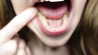 I Tell U About the Fillings in My Teeth and Dental Visits