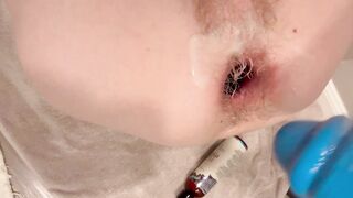 Tiny femboy gapes aperture with massive rod