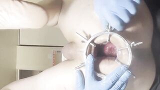 Reneenicolecd - update #110 - Anal spreader - Spikey Ball - Apple Vaccuum - Oct 05, 2026