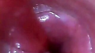 test tube shlong endoscope POV urethral insertion ball wang