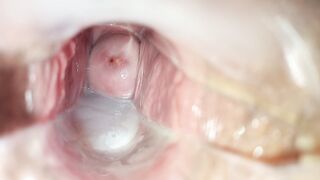 Cum inside cunt close-up speculum