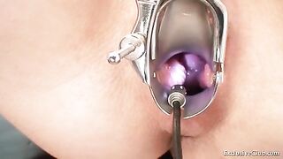 Breasty sweetheart gyno exam by dirty elder doctor