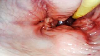 ASTONISHING INTERIOR POV. CAMERA INSIDE HER TWAT DURING THE TIME THAT I FILL HER WITH CUM