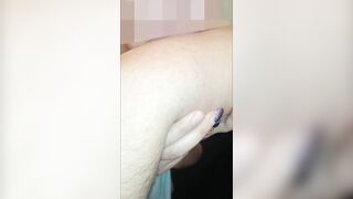 Beauty hard biting Marks