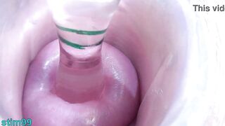 Lesbos cervix play penetration, fingering and void urine directly into the bladder of the other woman by peehole