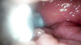 Jizz in Cervix Wide Stretching Snatch Endoscope!