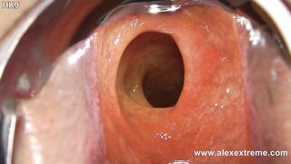 Incredible unfathomable anal view with XO speculum and light in Hotkinkyjo booty